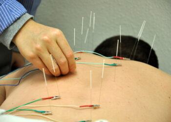 Health Benefits Of Acupuncture